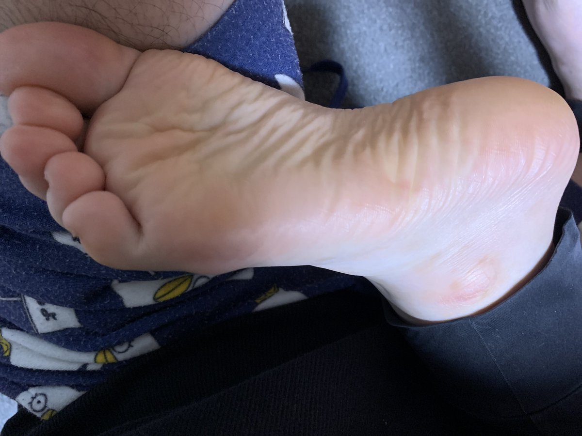 asisuki02's tweet photo. 嫁の足裏
仕事終わりで靴下脱ぎたての足裏
ほんのり酸っぱい
たまらないです
＃足裏
＃足裏フェチ
＃足フェチ https://t.co/ilVQ4EgfR9