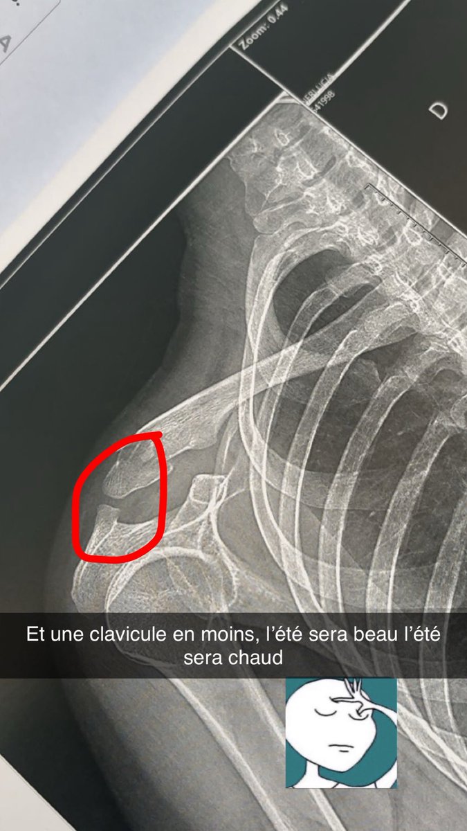 _liciia_'s tweet photo. L’été va être long mmdrr https://t.co/xaUJ3AtwaM