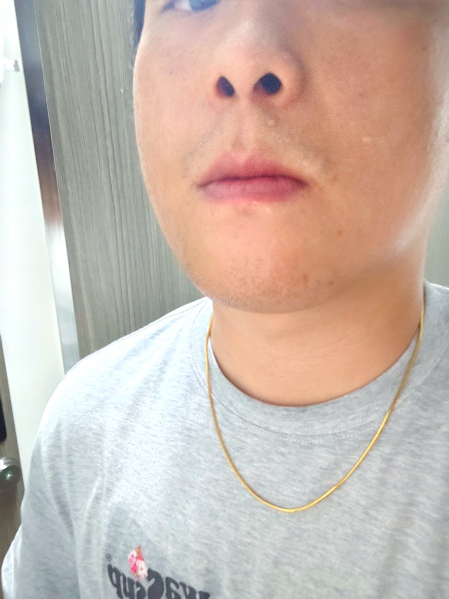 Sjc9552's tweet photo. 今日记录～昨晚熬夜加上吃了点东西零食个西瓜感觉又肿了。唉。 https://t.co/KcxOEUF0iE