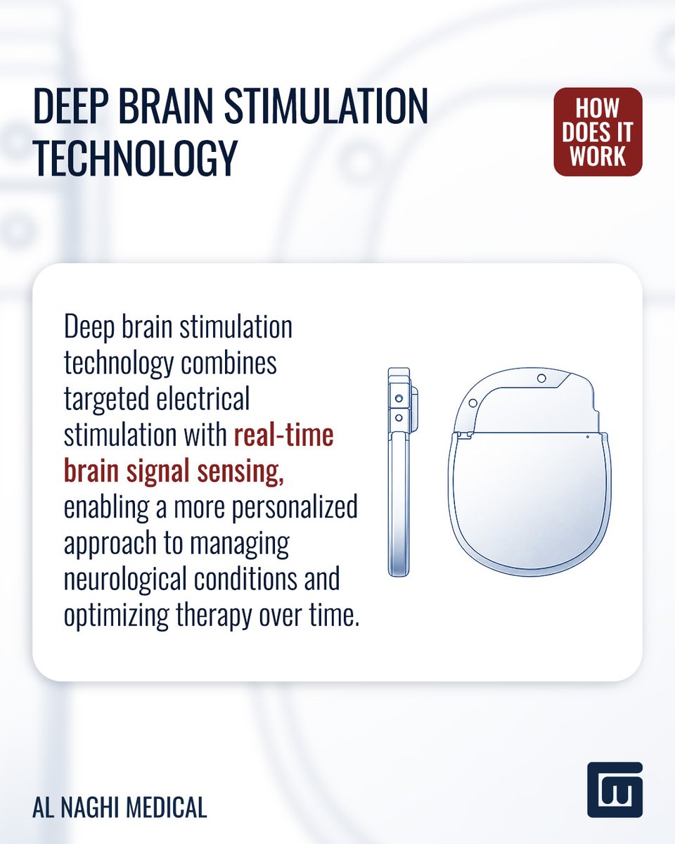 alnaghimedical's tweet photo. Deep brain stimulation technology combines targeted electrical stimulation with real-time brain signal sensing, enabling a more personalized approach to managing neurological conditions and optimizing therapy over time.
#deepbrainstimulation #neurology #alnaghimedical https://t.co/3T90a1nQGv