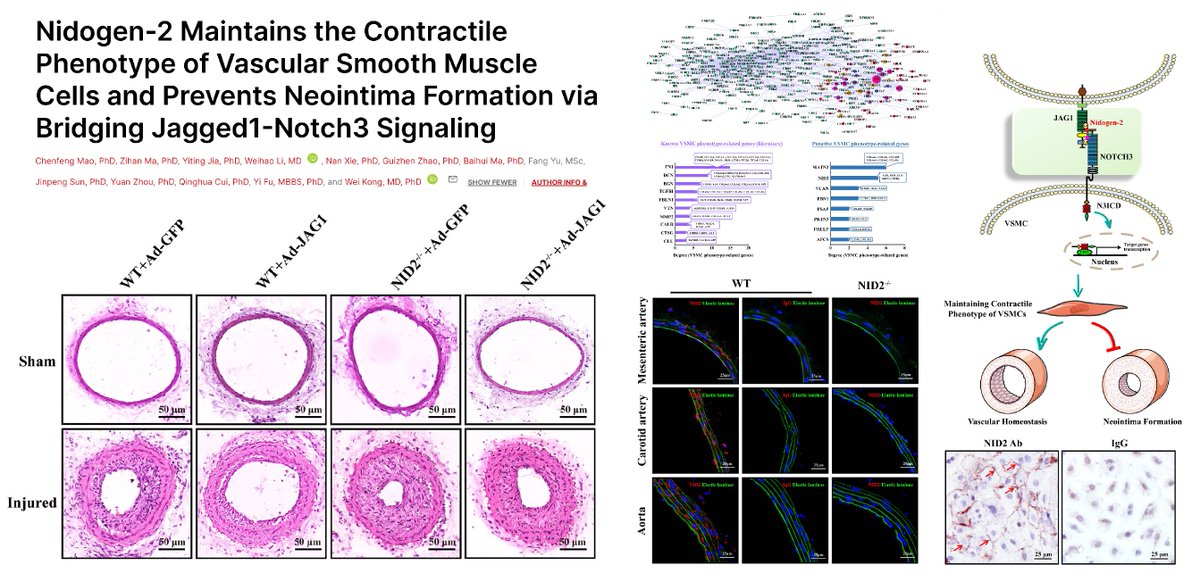 HaoYin20's tweet photo. Nidogen-2, a basement membrane component, directly binds to & activates Jag1 & Notch3 in Smooth Muscle Cell➡️⏫Contractile phenotype

Nid2 KO🐭➡️⏫Neointima in wire-injured carotid artery

Nidogen-2
⬇️in PDGFBB-treated or injured arterial SMCs
⬆️in serum-starved or TGFβ-treated SMCs

@CircAHA 2021
https://t.co/skUb0GZR3n