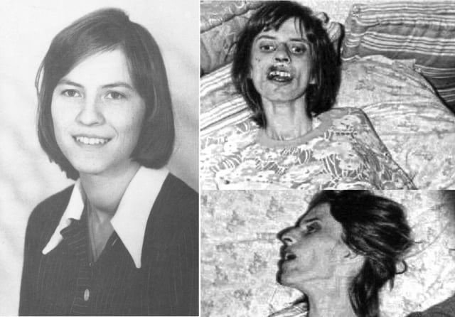 50YearsAgoLive's tweet photo. Anneliese Michel, a West German woman who has undergone multiple exorcisms by Catholic priests at the request of her parents, dies of malnutrition. She was 23. 

At the time of her death, she weighed only 30kg (65lbs) and had two broken knees and several broken ribs. https://t.co/DY37shbG7L