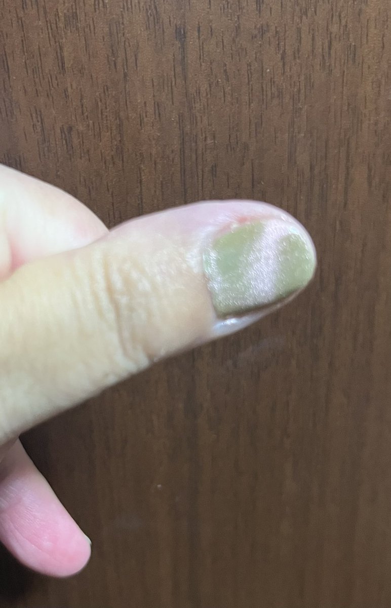 maumaman's tweet photo. 最近オキニのfingersuitのポリッシュ
2枚目:マグネットネイルのみ
3枚目:上からマグネットネイル重ね塗りしたらなにやらコガネムシみたいな色にwww https://t.co/z0D399uAJr