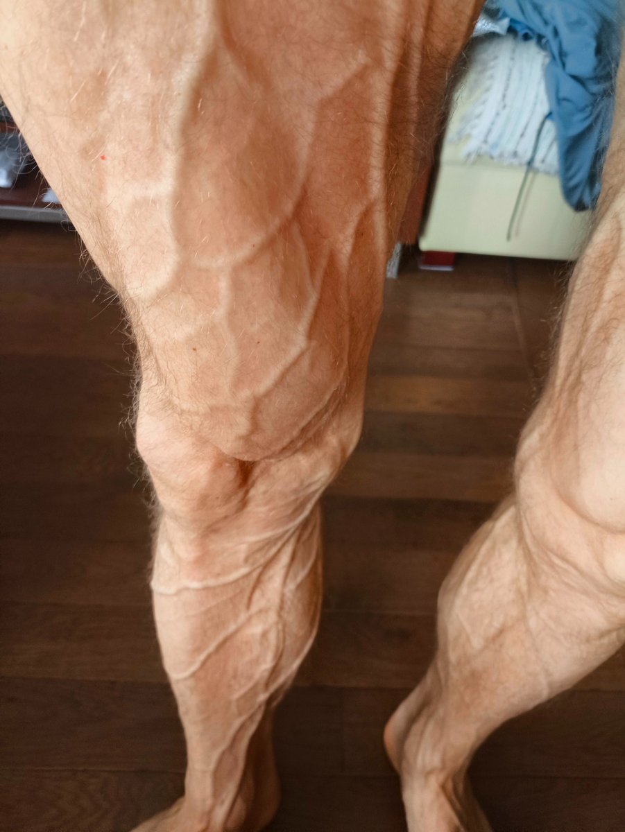 AlphaGymMaster's tweet photo. Veins popping out like a bodybuilder's at a competition... Except I don't take steroids like those losers...
What do you think—what's my body fat percentage? https://t.co/AlFMcRA2t5