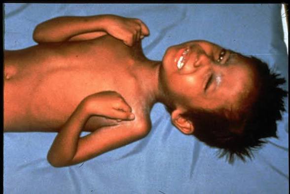 DrNeilStone's tweet photo. Imagine a world without vaccines https://t.co/S5rhwXQbTy