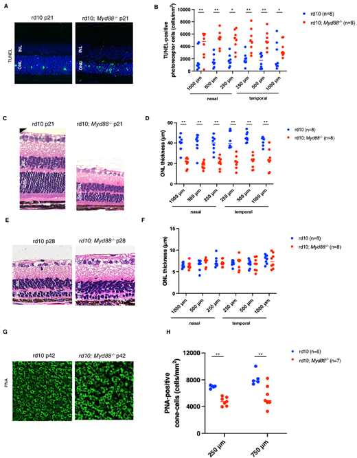 ARVOiovs's tweet photo. Yusuke Murakami et al. from Kyushu University find that Myd88 deficiency accelerates retinal degeneration and alters microglial dynamics in a mouse model of retinitis pigmentosa. 
https://t.co/NVfCaAFpqH https://t.co/i3QBouJ5kW