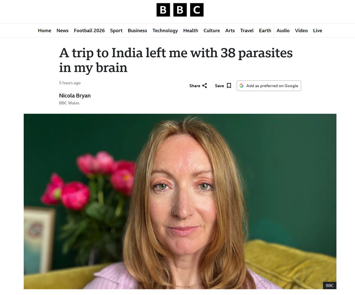 zhao_dashuai's tweet photo. Hmm, I wonder if the retarded behavior of so many indians are caused by these brain parasites.

If you go do india, the moment your lips touch their food and water, is the moment where parasitic eggs will enter your body.

The absence of basic hygiene and fondness of animal poop, are all contributing factors.