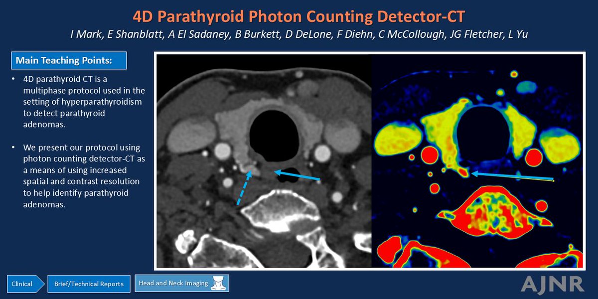 TheAJNR's tweet photo. "4D Parathyroid CT Using Photon-Counting Detector CT"

https://t.co/f1N6yCyRdf

@iantmark @mayoradiology https://t.co/aA8zO7ZEE2