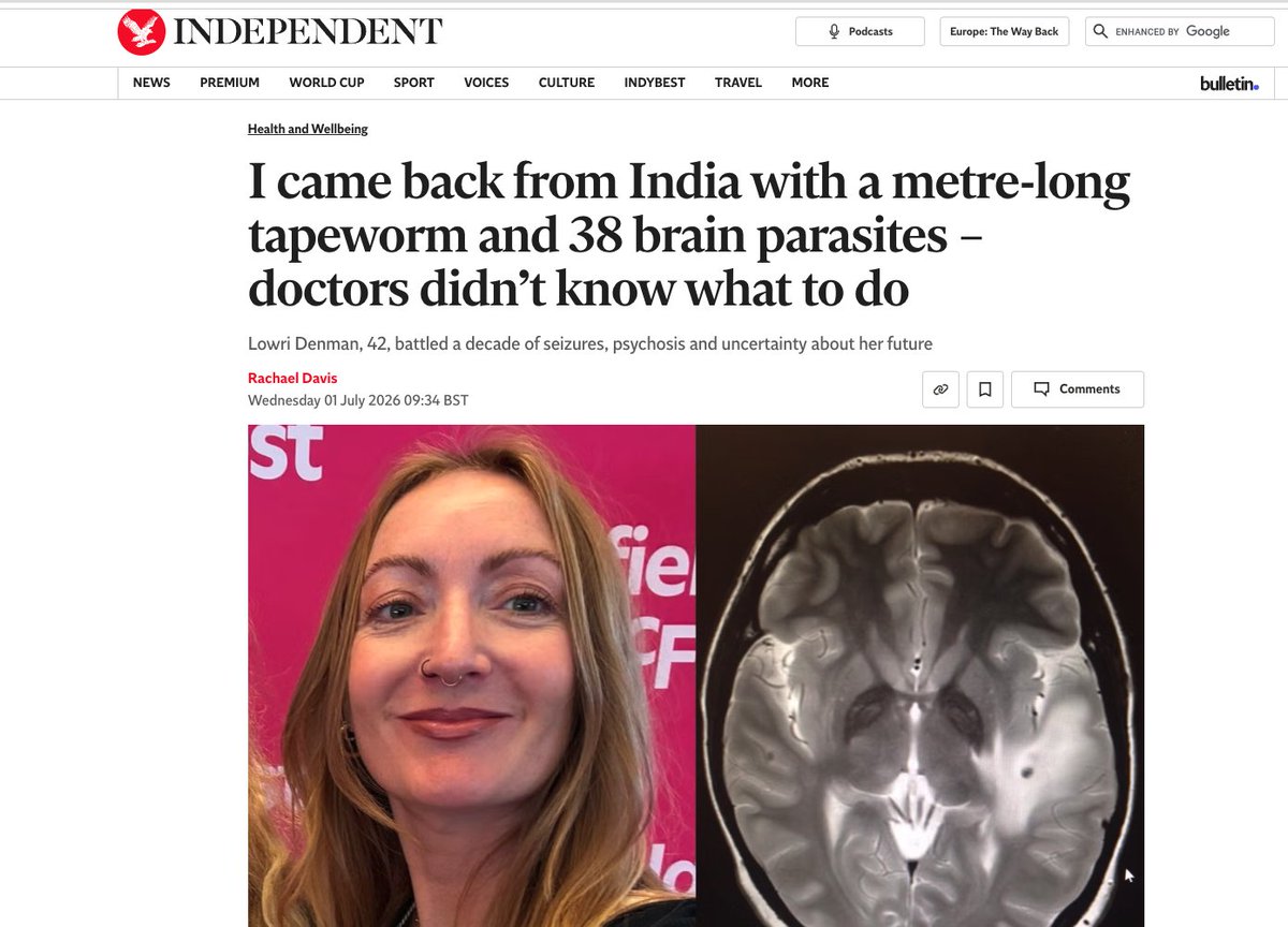VijayGajeraO's tweet photo. British Media is now doing a hit job on Indian tourism.

Facts about this case.

1. She visited India in 2007 and was diagnosed in 2011, got treated in the next few years, but got published now!

2. Without DNA sequencing or phylogenetic testing to prove the parasite came from a specific South Asian strain, doctors are just playing a guessing game. They saw "India" in her past travel history and immediately pinned it on that to create a neat, dramatic story.

3. You get them by ingesting microscopic eggs through contaminated water or poor hand hygiene. That can happen literally anywhere.