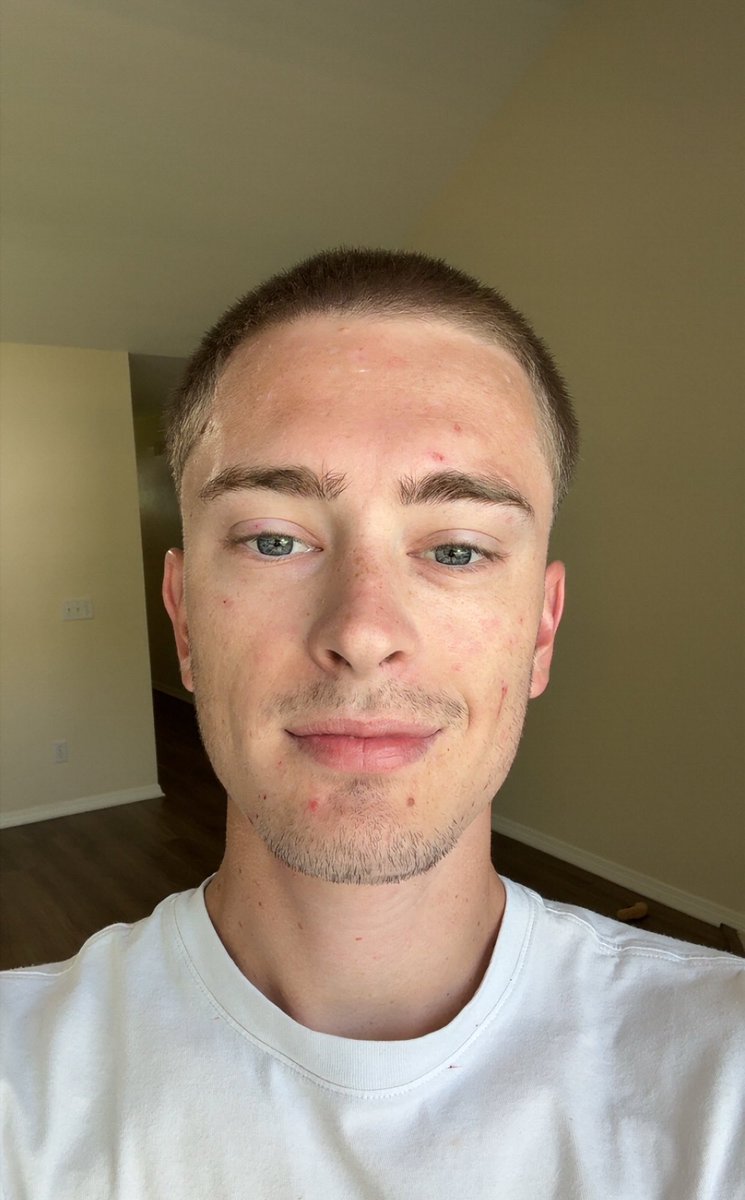 9trevv's tweet photo. I’m officially 1 year sober from meth 😁 https://t.co/MeNZKIrVVK