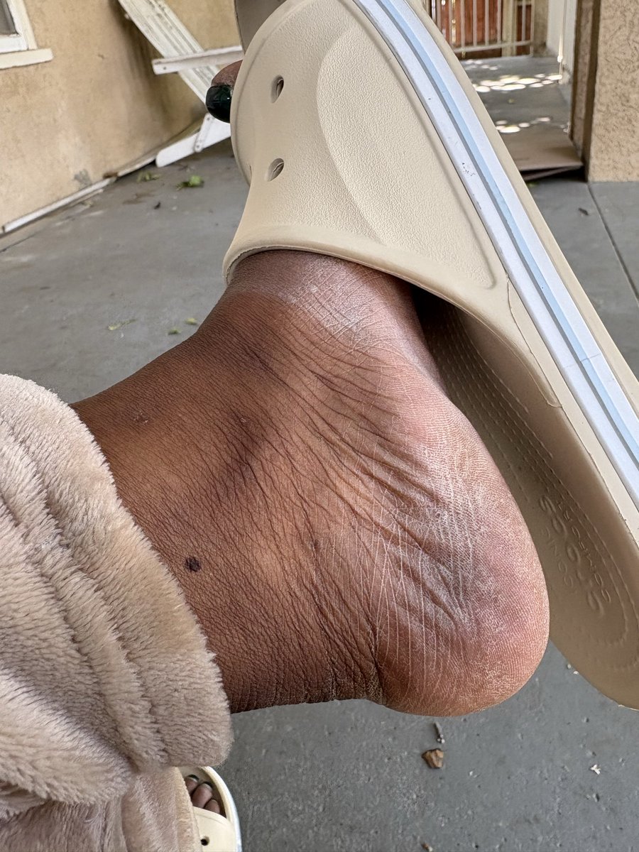callusqueen's tweet photo. Every inch demands respect. 👣

#CallusQueen #Feet #FootFetish #FootWorship #DirtyFeet #CallusedFeet #DryFeet #BareFeet #FootLover #FootAdmiration #FootSlave #FootAddict #FootHumiliation #FootObsession #Findom https://t.co/742z3KcPGY