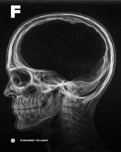 mikael_benoit's tweet photo. @maxliberto Messi est plus petit que ton cerveau. 
⬇️OUPS ⬇️ https://t.co/bmOUhCyO0m