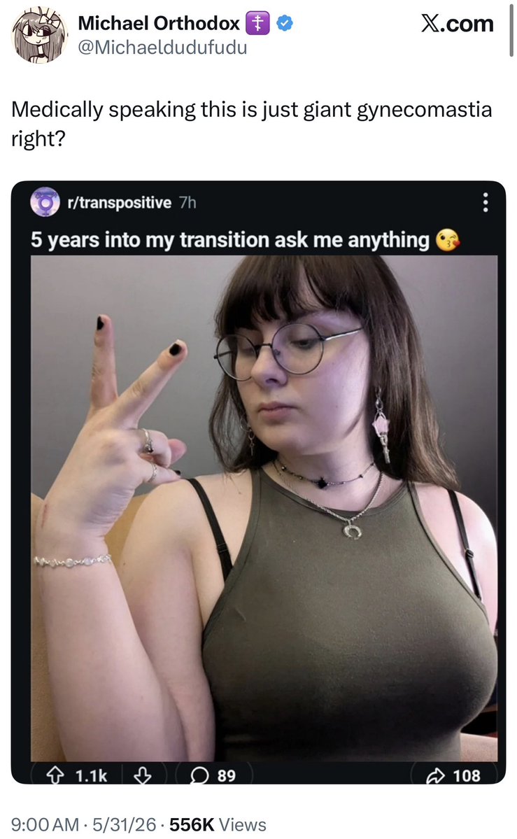 InsanePPLCoping's tweet photo. Context https://t.co/Vs1YUuwCl3