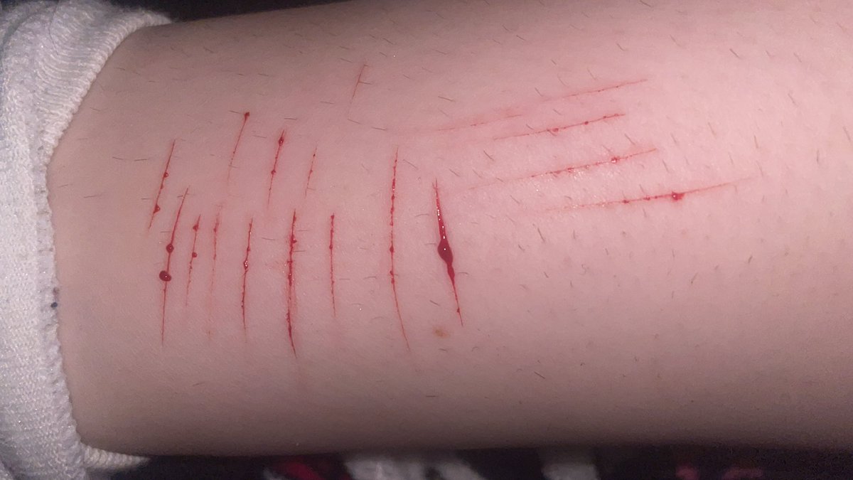 anaduduu's tweet photo. Ummm I accidentally did my first styro whilst trying out a new cutting spot??? Wtf???

Don’t mind my hairy legs https://t.co/v42jknQ8Mu