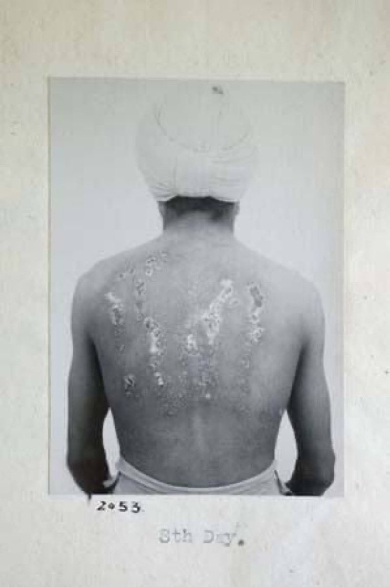 CommanMan777589's tweet photo. The Indian Holocaust- This must go viral

Hitler did not come to India - Then who put 20000 Indian Army Soldiers in Gas Chambers??

The Britishers did- 1930  British Holocaust on Indians for 10 years suspected to have killed over 20000 soldiers

This story won’t give you goosebumps. 🇮🇳💔

It will leave you in silence.

History often speaks of wars, but stays silent about what happened behind closed doors.

In the 1930s and 1940s, soldiers of the British Indian Army were taken to military testing programs linked to Porton Down.

Inside controlled gas chambers in Rawalpindi, Indian Army soldiers were exposed to mustard gas.

Not in battle.

In experiments.

They were made to stand inside sealed chambers wearing minimal clothing so the effects on skin, eyes, and lungs could be studied.

What they endured was not warfare it was observation.

Hundreds were exposed.

Many suffered severe burns. Many developed long-term respiratory and eye damage. Some were hospitalized for weeks.

Consent was not truly informed. Within the structure of colonial military authority, refusal was not realistically possible.

For years, this remained hidden from public view.

Later reporting, including by The Guardian, brought fragments of this truth into light.

This was not a battlefield.

This was controlled human experimentation done in the name of research.

And the people inside those chambers were Indian Army soldiers who had no real choice in what they were part of.

Some parts of history are not meant to give chills.

They are meant to leave you with silence.
