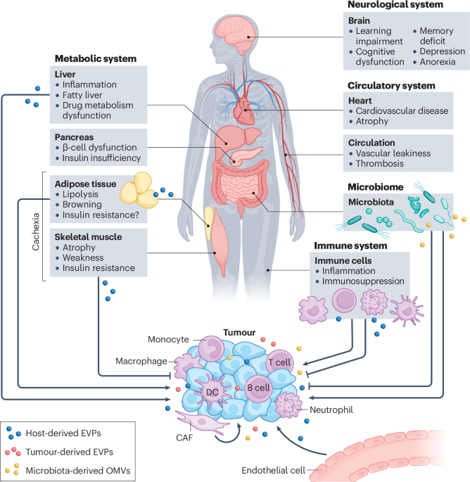 NatureRevCancer's tweet photo. NEW content online! Systemic health impact of cancer-associated extracellular vesicles and particles https://t.co/9vqlUPaUbk https://t.co/QjrSxBDlRL