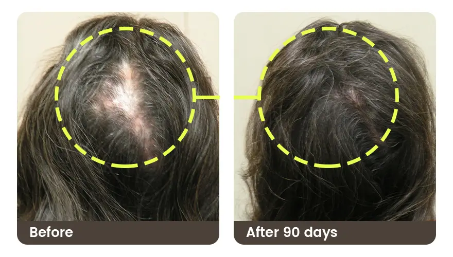 doctormorphh's tweet photo. Apply melatonin in your scalp to have your hair grow like grass, please dont use it for sleep. https://t.co/UOxutyEOfl