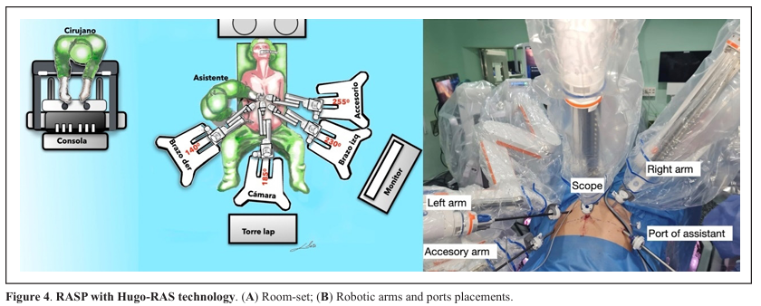 UTJeditor's tweet photo. 🗣️Call for reading and sharing 
Robot-assisted simple prostatectomy versus laparoscopic simple prostatectomy: a narrative review of the literature and the state of art
URL:   https://t.co/MixpZVHD8f https://t.co/bGJ9TPEZ02