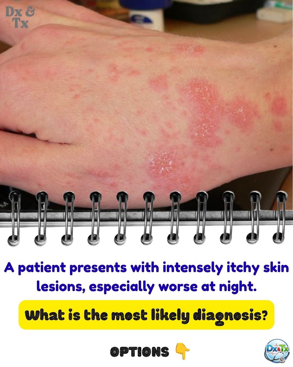 DrMedica_13's tweet photo. Diagnosis? https://t.co/wqUJfzXpPE