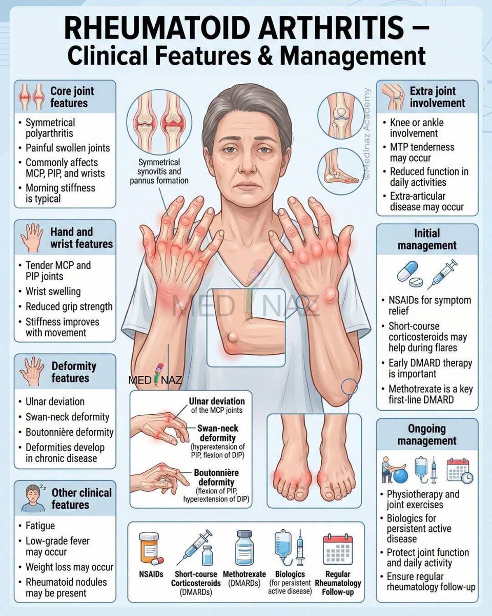 FutureRN_2028's tweet photo. Rheumatoid Arthritis https://t.co/fZZDcWFywF