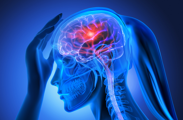PabloFuente's tweet photo. 🧠 UN TRATAMIENTO MEJORA LA RECUPERACIÓN TRAS UN ICTUS GRAVE

Después de que los médicos logren abrir la arteria obstruida en un ictus, muchos pacientes siguen con secuelas graves porque persisten problemas en los vasos más pequeños. Un ensayo clínico aleatorizado con más de 1.300 personas en China probó añadir tirofiban (un fármaco que actúa sobre las plaquetas) justo después de la intervención: el 49 % de los que lo recibieron recuperaron independencia funcional a los 90 días, frente al 43 % con placebo.

Esto significa que un paso sencillo al final del procedimiento puede aumentar las probabilidades de volver a caminar, hablar y cuidar de uno mismo sin ayuda. Los riesgos de hemorragia grave o muerte no subieron de forma significativa.
Estudio del equipo del prof. Wei Wang y Xiang Luo en Tongji Hospital, Huazhong University of Science and Technology, publicado en @TheLancet.
https://t.co/dC2Kv0VvvQ