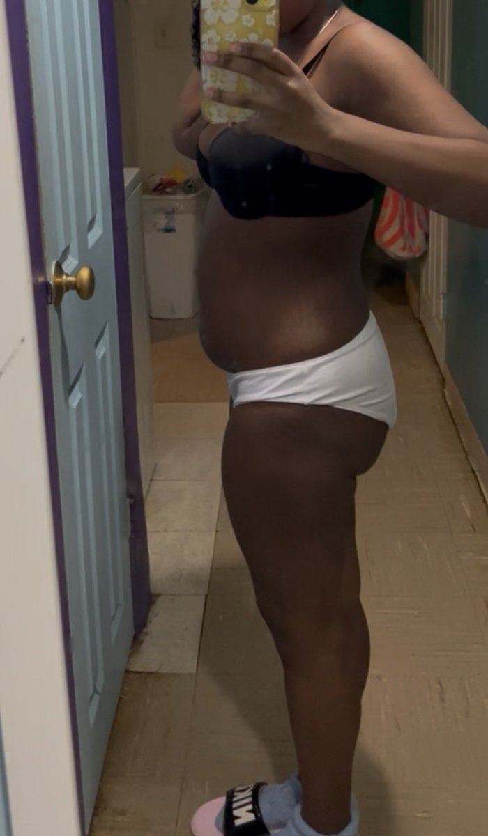 Idkman__o7's tweet photo. comparisonspo except both photos are me #bodycheck #edtwt #anatwt https://t.co/peH519ECBv
