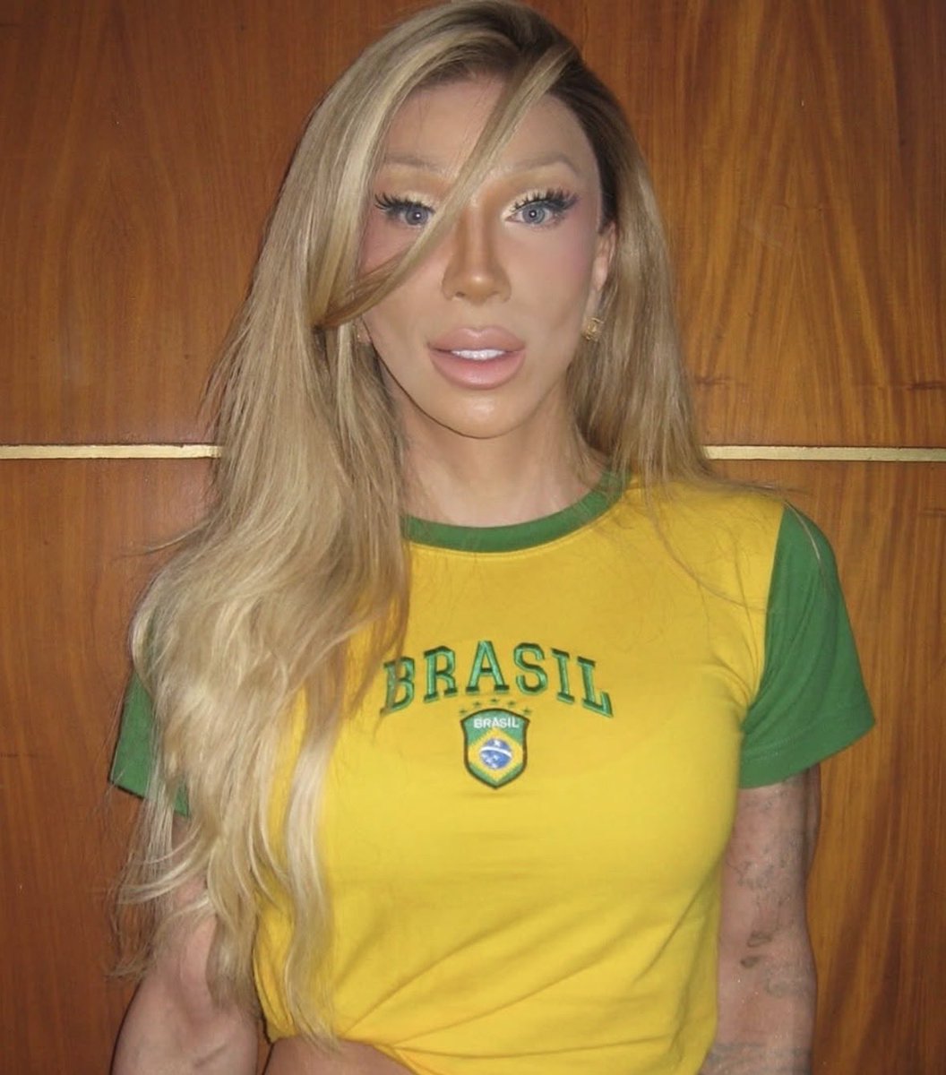 QGdoPOP's tweet photo. 🚨 MEU DEUS! Maya Massafera faz cirurgia inédita no Brasil e se torna a primeira pessoa no país a realizar cirurgia de diminuição das costas. https://t.co/khPkVGuwDo