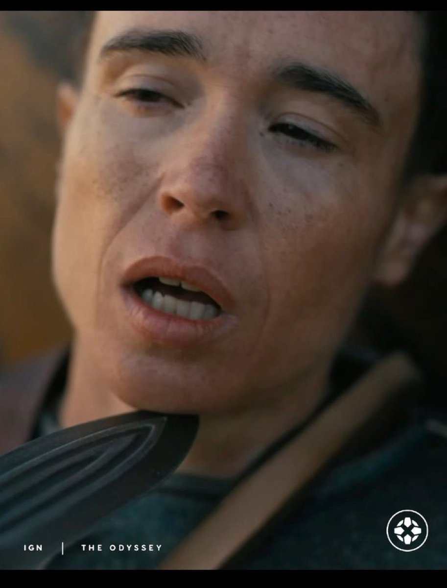 HowlingBones2's tweet photo. When they don’t stop sucking on your forearm graft https://t.co/9tIZotRfNW