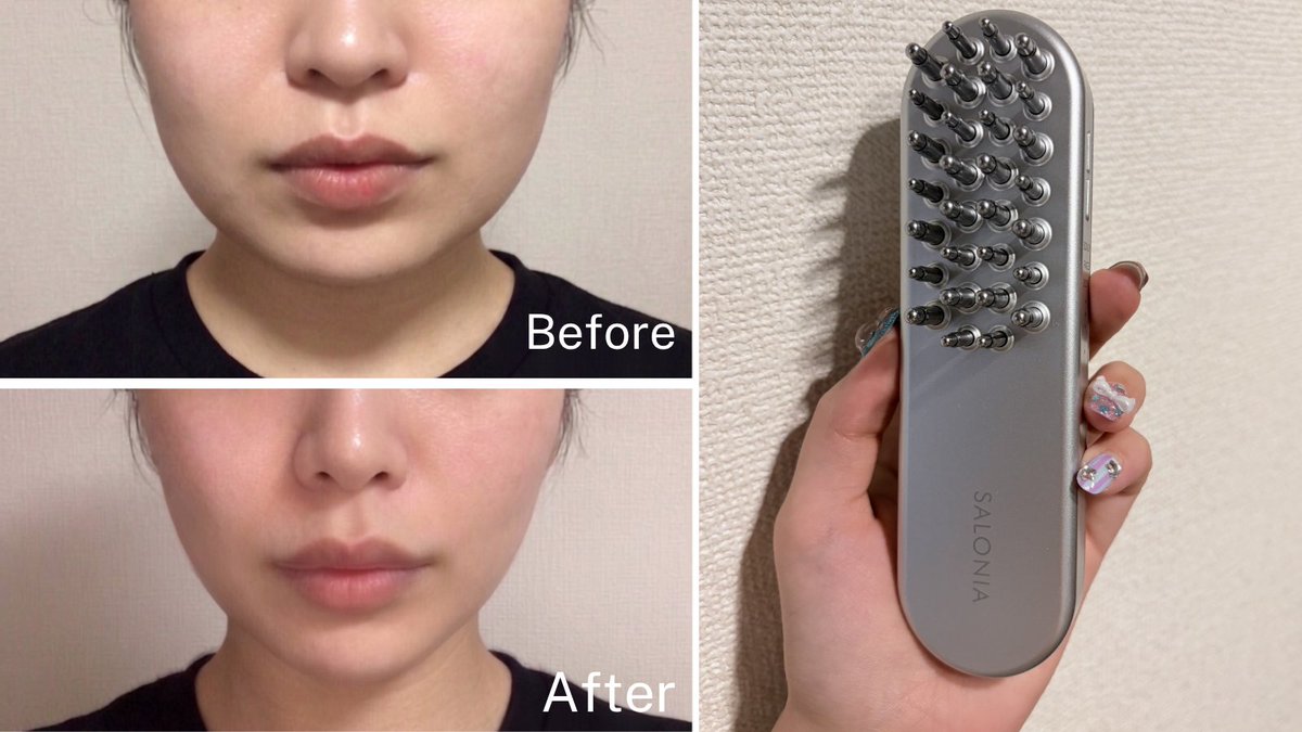 美顔器 バズってたこの美顔器めちゃくちゃむくみが取れるんだけど