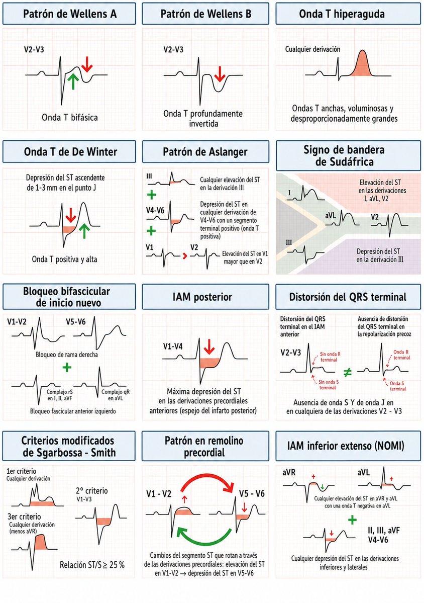 ENARM_intensivo's tweet photo. 💢PATRONES  ELECTROCARDIOGRÁFICOS  DEL  INFARTO  AL  MIOCARDIO  POR  OCLUSIÓN   

#ENARM_INTENSIVO #ESTUDIA_MEDICINA https://t.co/sxog7Dn7Cd