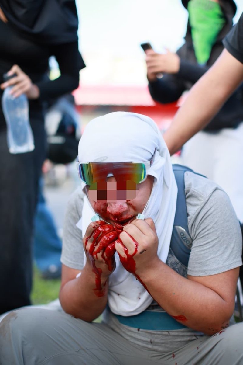 jeanellydvg's tweet photo. #AlertaUSAC 🚨

Adentro del campus central de la USAC hay personas con pasamontañas disparando bombas lacrimógenas y gel pimienta contra los estudiantes. Se reporta un primer herido. 

Desde la mañana, estudiantes y egresados sancarlistas se reunieron afuera del campus para manifestar en contra del segundo periodo de Mazariegos como rector.