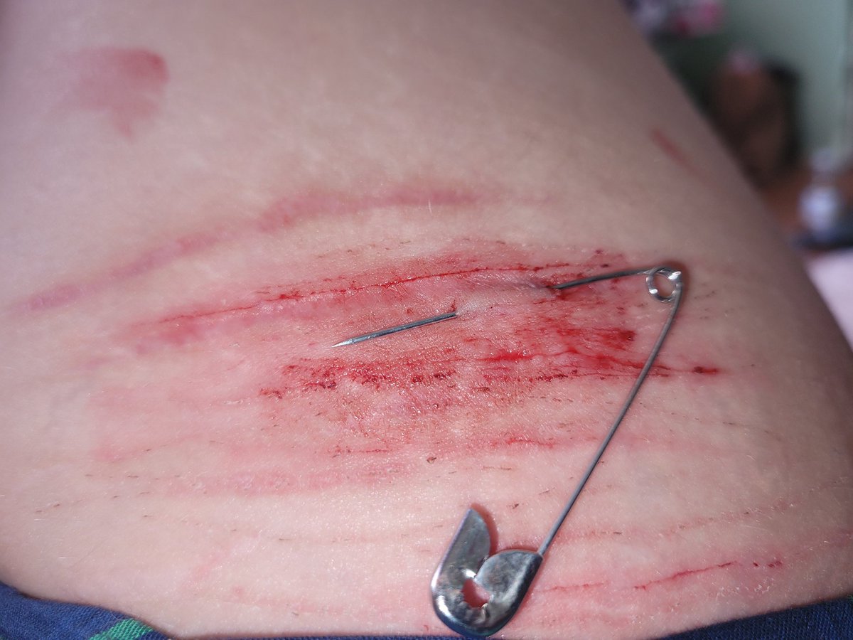 EyeOfMisery's tweet photo. Does this count as a play piercing,? #shtwt 

All fake sfx https://t.co/hZwNOgx1uE