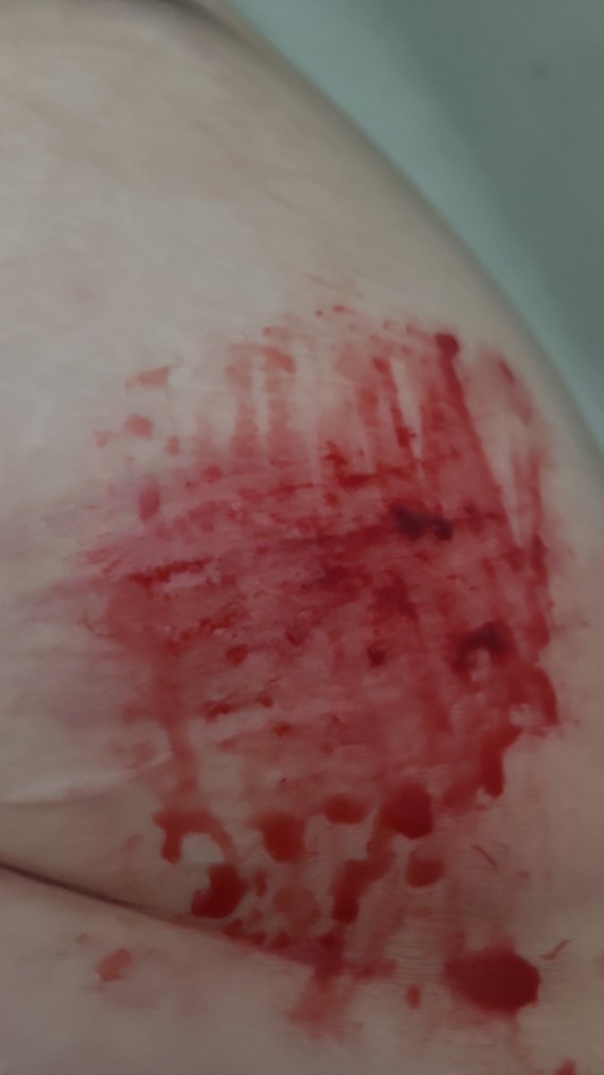 EyeOfMisery's tweet photo. Fresh sesh! #shedtwt (all fake sfx) https://t.co/ghYJ3s6D4F