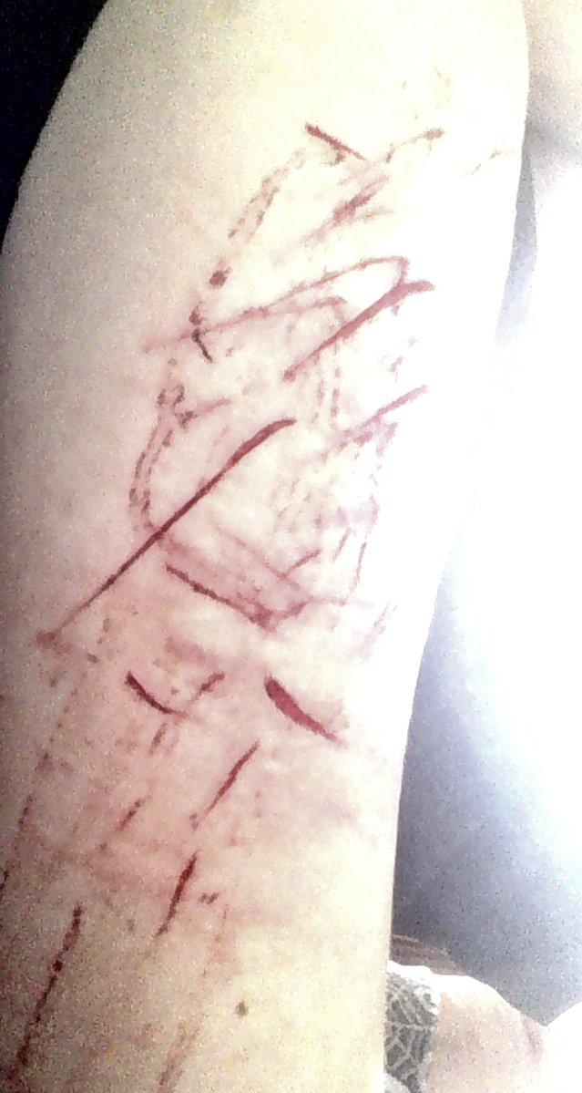 EyeOfMisery's tweet photo. Pretty. #shedtwt (all fake sfx fake body not real) https://t.co/hYi4mMW44i