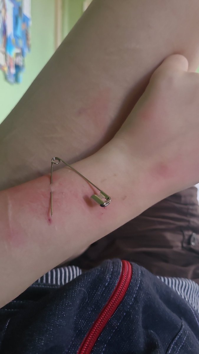 EyeOfMisery's tweet photo. Play piercing?? Kinda? 
#shtwt all fake sfx https://t.co/V39QhtEoTr