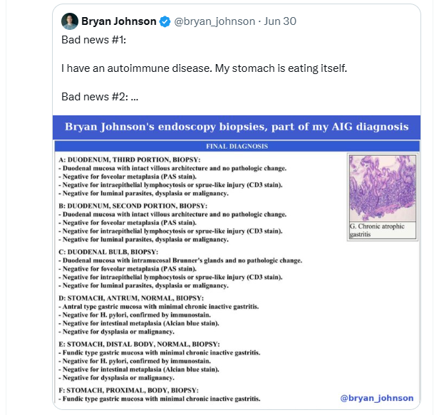 Hitman50459601's tweet photo. @DrJackKruse he has several diseases - here's the post https://t.co/QTWJiXkCQW