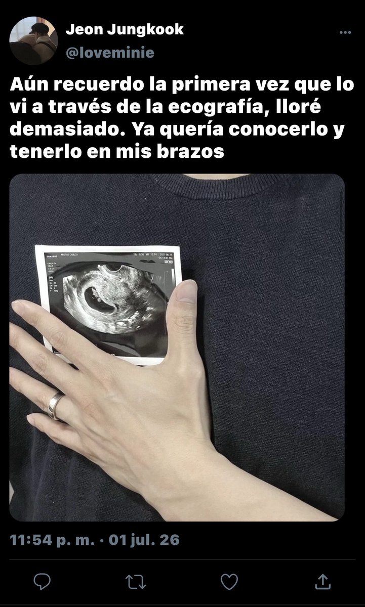 lilykooktales's tweet photo. a few tweets 🍼🐣 #kookminau

Jm acaba de tener a su bebé, y Jk es el hombre más feliz de todo el mundo https://t.co/V0jIGBnPxU