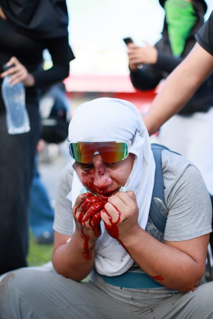 AlexEnLaLucha's tweet photo. Violencia y agresiones físicas por parte de los empleados de Walter Mazariegos para los estudiantes que buscan el rescate de la única universitaria publica y gratuita de Guatemala.

Armas de fuego y bombas para atacar un digna resistencia. https://t.co/d0zHtkWTtv