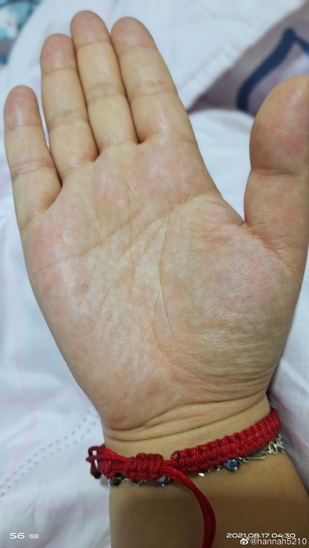 isauracorujo's tweet photo. The scars on your palms from gripping tight during tough times They’re not wounds—they’re proof you held on, learned, and grew stronger than you planned. https://t.co/ergU4ZvbkK