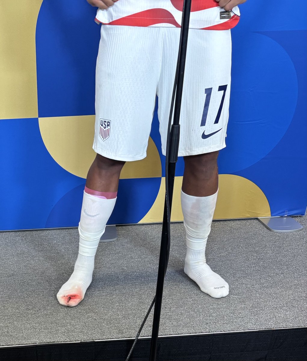 SoccerInsider's tweet photo. Malik Tillman and the bloody sock … https://t.co/H4E1XLnV9d