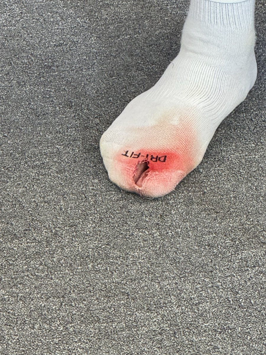 PaulTenorio's tweet photo. Malik Tillman got stepped on. It ripped his boot and his sock. “I was in pain,” he said. New cleat for the free kick. It worked out ok. 

https://t.co/ol2VJA0cjY https://t.co/vi2adBXjIc