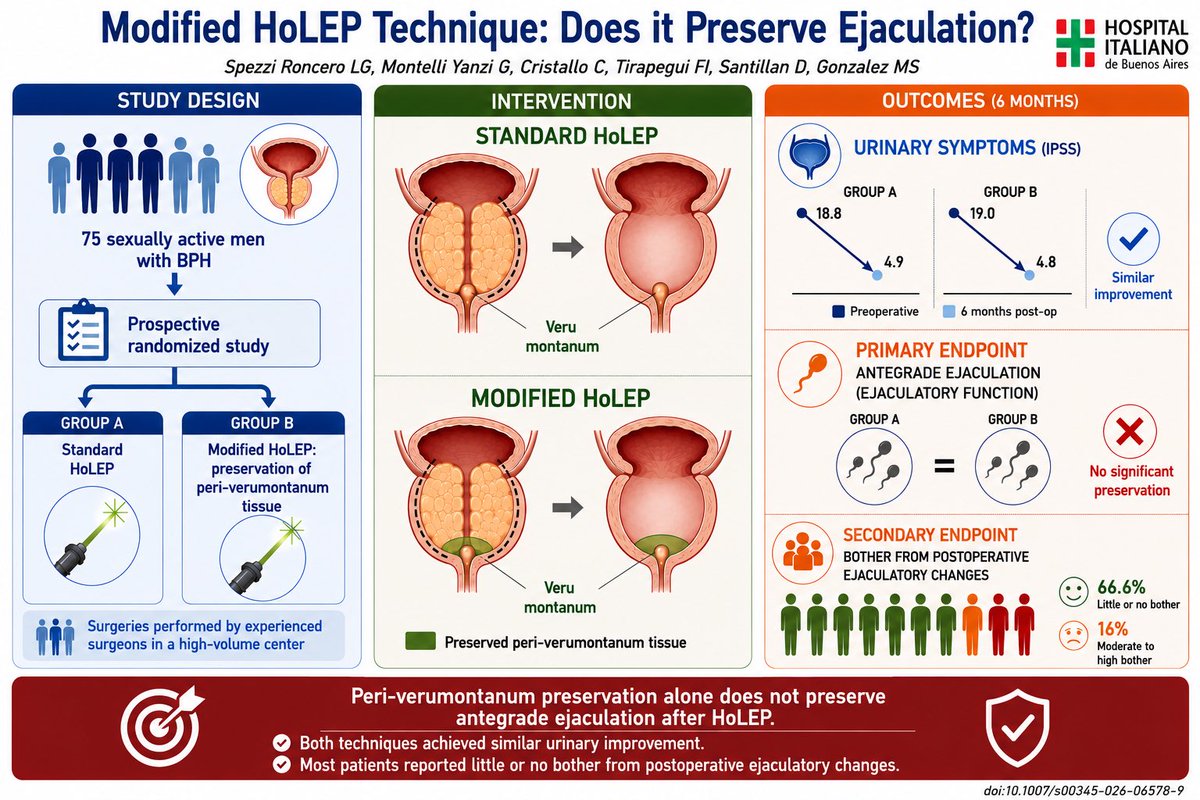 GMontelliYanzi's tweet photo. 🧵 1/3
📢 New publication‼️
Can preserving peri-verumontanum tissue during #HoLEP preserve antegrade ejaculation?
We conducted a prospective randomized study to answer this question.
📄 doi:10.1007/s00345-026-06578-9
@wjurol @SpringerUrology @UroHIBA https://t.co/3el45lDqBy