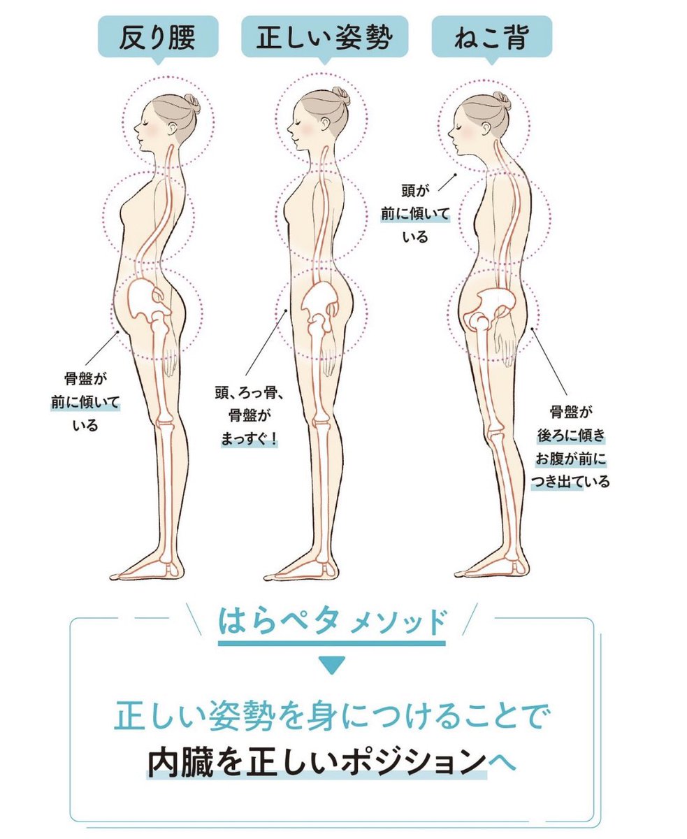 moritaku6's tweet photo. 下腹がぽっこり出てしまう原因に、立ち方があります。1枚目のイラストのように、反り腰や猫背てわ骨盤を前に突き出すように立ってしまっていませんか？
台所に骨盤を押し付けていたりする人は要注意です！

試しに骨盤を踵側まで後ろに持っていき、足と骨盤、頭を垂直にすると、お腹にテンションがかかって、自然と力が入るかもしれません。

普段から姿勢を潰して、骨盤をずらして立っている人は、脚の骨の付け根が前に迫り出し、前ももや外ももが太くなるだけでなく、お腹がやるべき上半身を支える力をももと腰で代償します。

このせいでお腹は弛み、ももと腰へ負担が増すという悪循環に。

立ち方次第でお腹の出方がかわります。

改善には、2枚目の写真のようなストレッチが有効ですが、この時もお腹の力が抜けないように、前に迫り出さない（3枚目NG写真）のがポイント。

ももの付け根をストレッチしながらも、下腹の筋肉を鍛えるイメージでストレッチをするのが効果的です