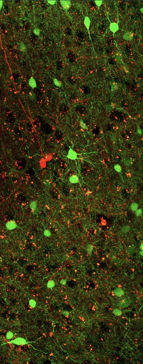 _Neuronal_'s tweet photo. Mouse mPFC: c-Fos (an immediate-early gene marking recent activity) paired with a tdTomato activity tag, plus GAD67-GFP to flag inhibitory neurons.
#neuroscience #PFC #behavior https://t.co/rjeTNBXzVt