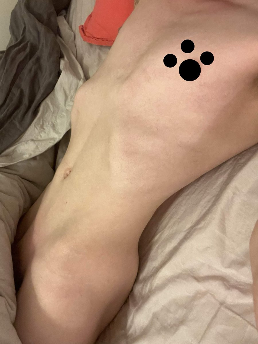ChewiKera's tweet photo. Mwehee :3 when am i getting pinned to my bed and teased :3 
#nsfwtwt #nsfw #nsfwpic #nsfwphoto #boypic #goodboy #puppyboy #mommysboy #boybottom #msub #nsfwmsub https://t.co/vDvwnrm31I