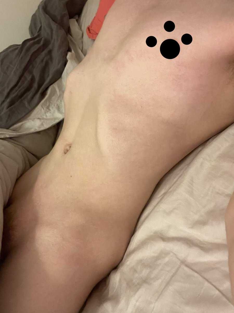ChewiKera's tweet photo. Mwehee :3 when am i getting pinned to my bed and teased :3 
#nsfwtwt #nsfw #nsfwpic #nsfwphoto #boypic #goodboy #puppyboy #mommysboy #boybottom #msub #nsfwmsub https://t.co/vDvwnrm31I