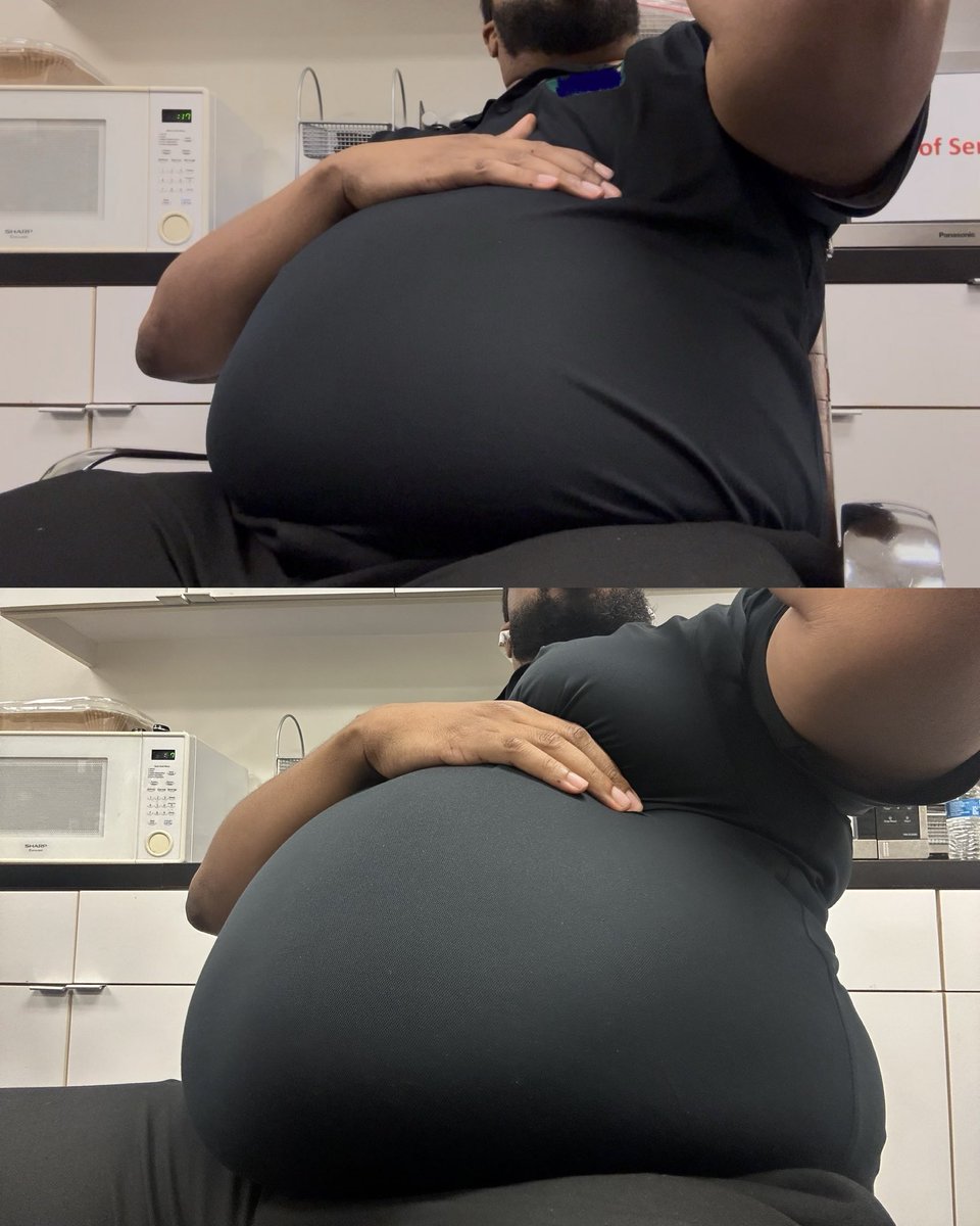 chunkyhandle's tweet photo. 4 months difference… https://t.co/JQsixtTzWg
