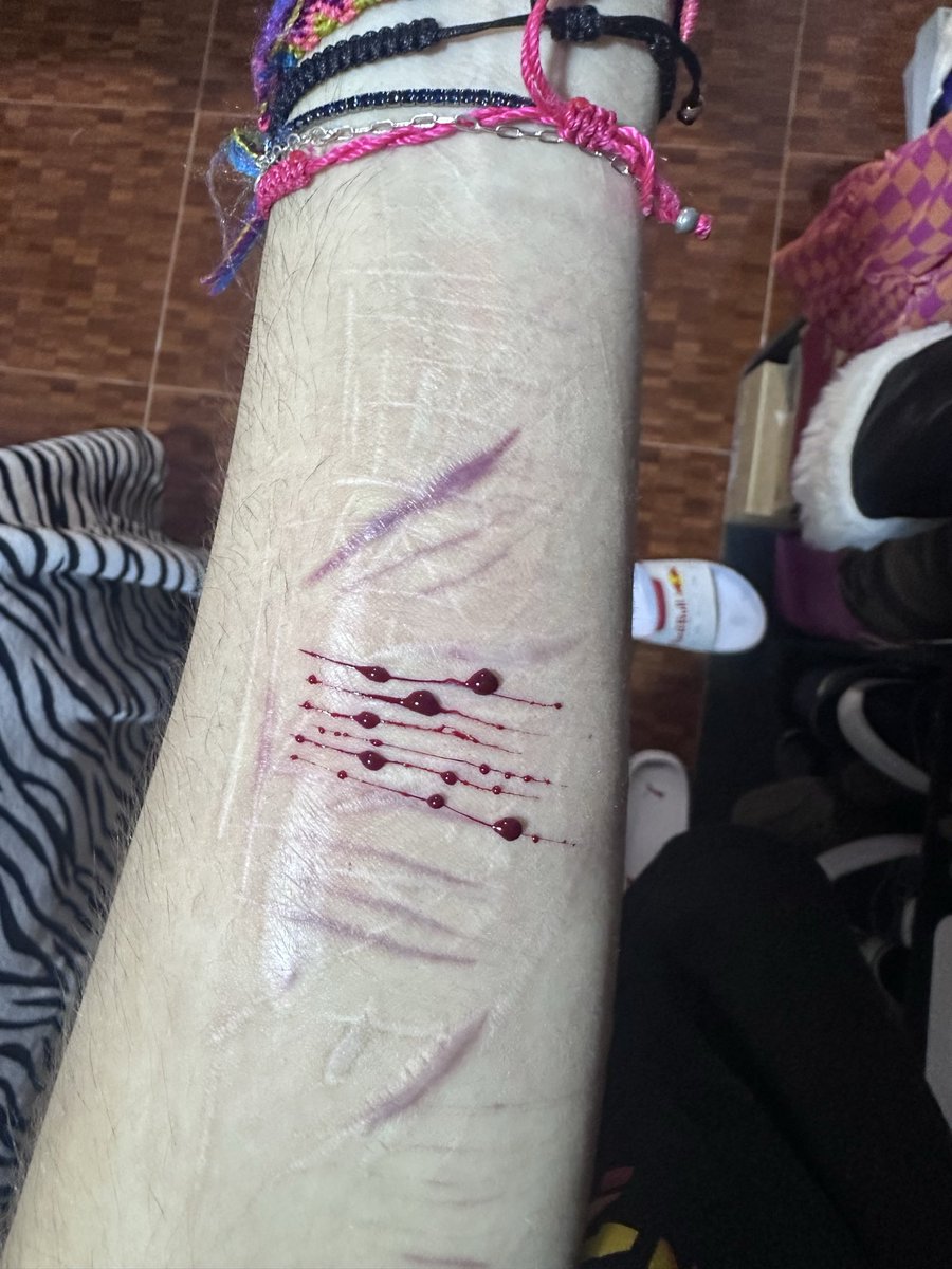 dyevenknowme's tweet photo. eh vuelto chat https://t.co/YumxFr0Txj