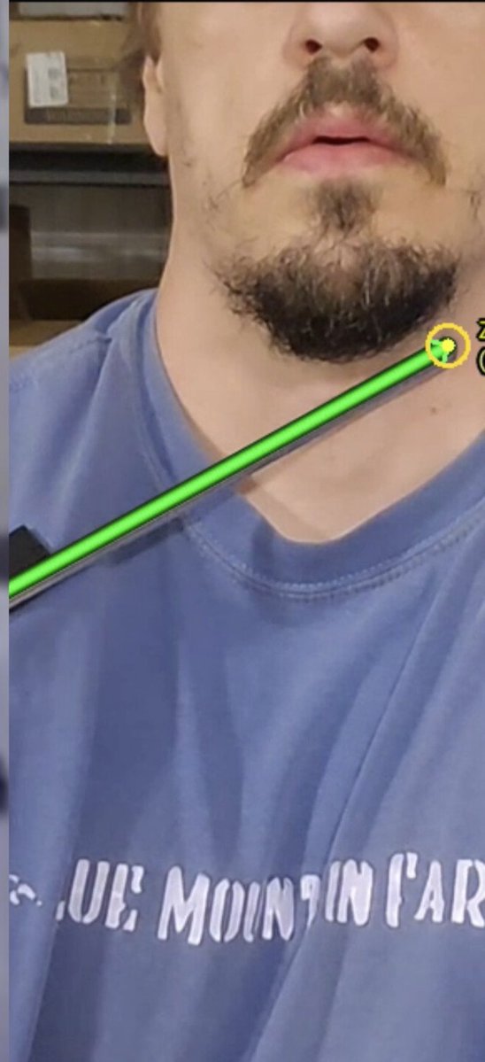 Freedom_ForgeUS's tweet photo. @jonaaronbray Adams Apple excuse? The hell are you talking about. 

Lol, look at how far off your wound marker is. It’s hilarious and yet, the sheep stumble in. https://t.co/v3ByDX9jqY
