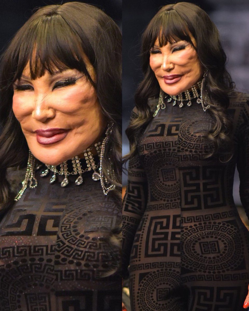 nvmadii's tweet photo. Hey @grok, fix her face and show me how would she look normal !! https://t.co/d9k3NKmkEo